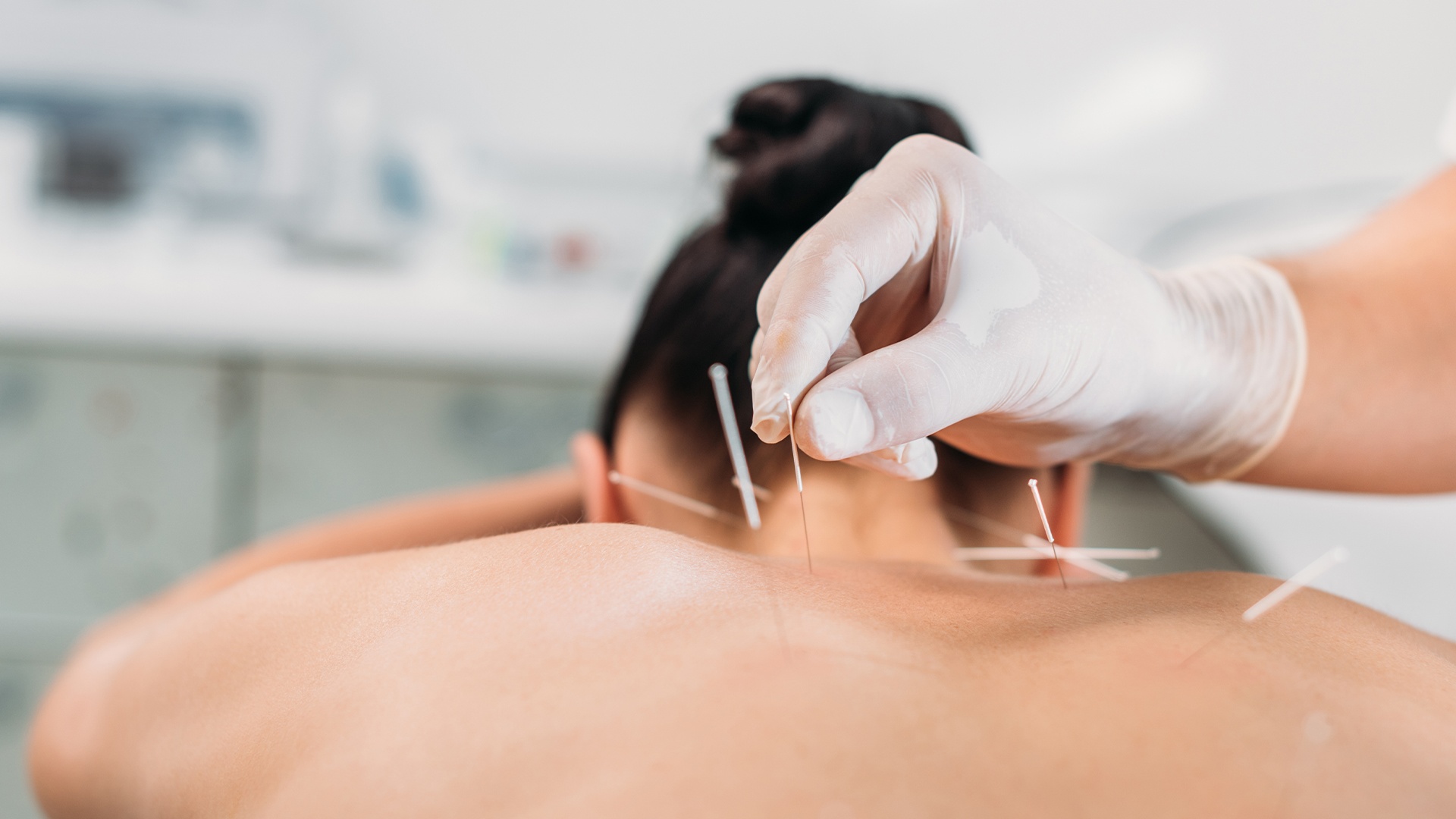 Lifestyle Resort Zum Kurfürsten in Bernkastel-Kues – Akupunkturbehandlung im Wellnessbereich | Wellnesshotel Mosel